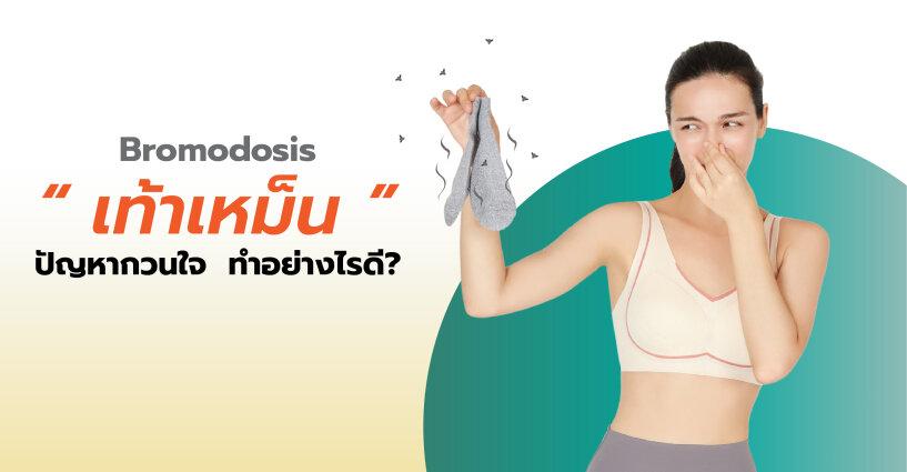 "เท้าเหม็น" ปัญหากวนใจ ทำอย่างไรดี!?