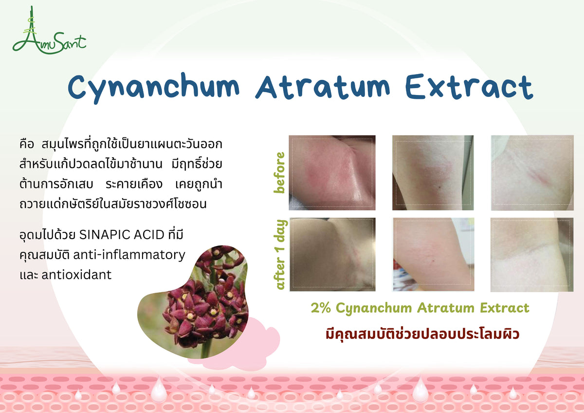 Amusant By Enfant ครีมทาผื่นผ้าอ้อม ครีมทาผื่นเด็ก ปกป้องผิวลูกน้อย ลดการระคายเคือง บำรุงผิวแห้ง สูตรอ่อนโยน EC100L